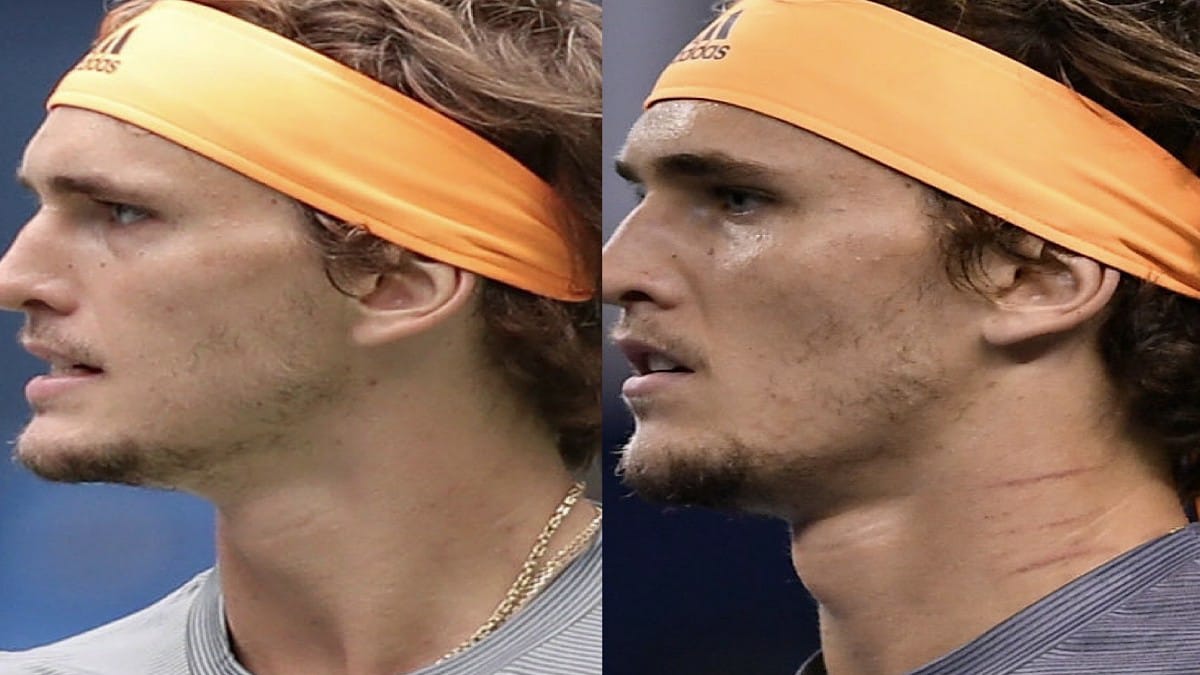 Blast from the past: Scratches spotted on Alexander Zverev from 2019 Shanghai Masters