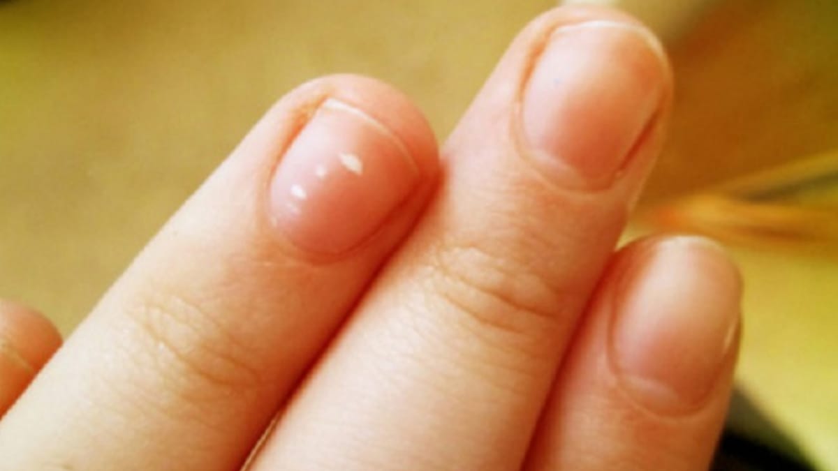 Common Signs of Nutritional Deficiency