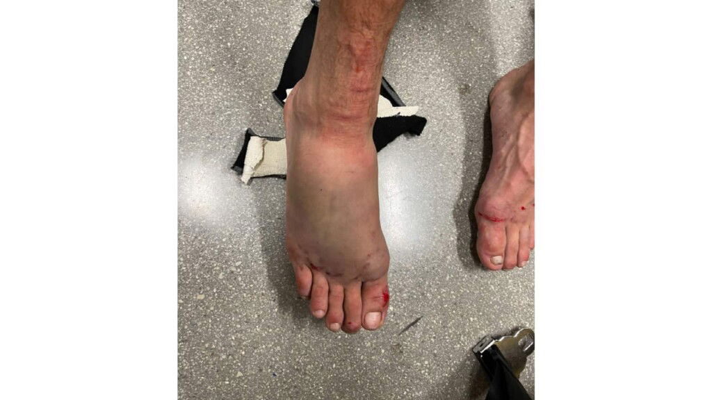 "It's blown up," UFC President Dana White concerned for UFC fighter's brutal injury following UFC Vegas 42 main event 2 Yair Rodriguez's foot
