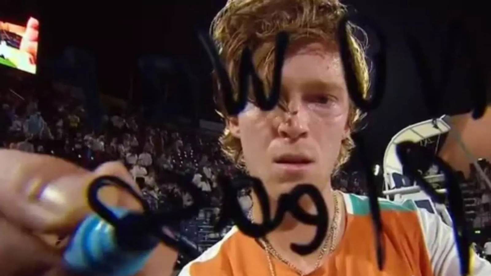 “Shame on you” Tennis world stunned to see Russian players who have spoken against war, get banned from Wimbledon
