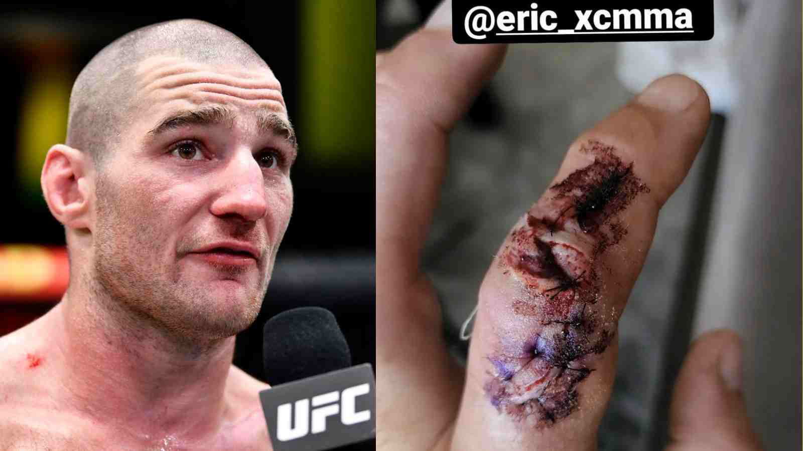 Sean Strickland suffers repugnant finger infection, sidelined for 3 weeks ahead of Jared Cannonier fight