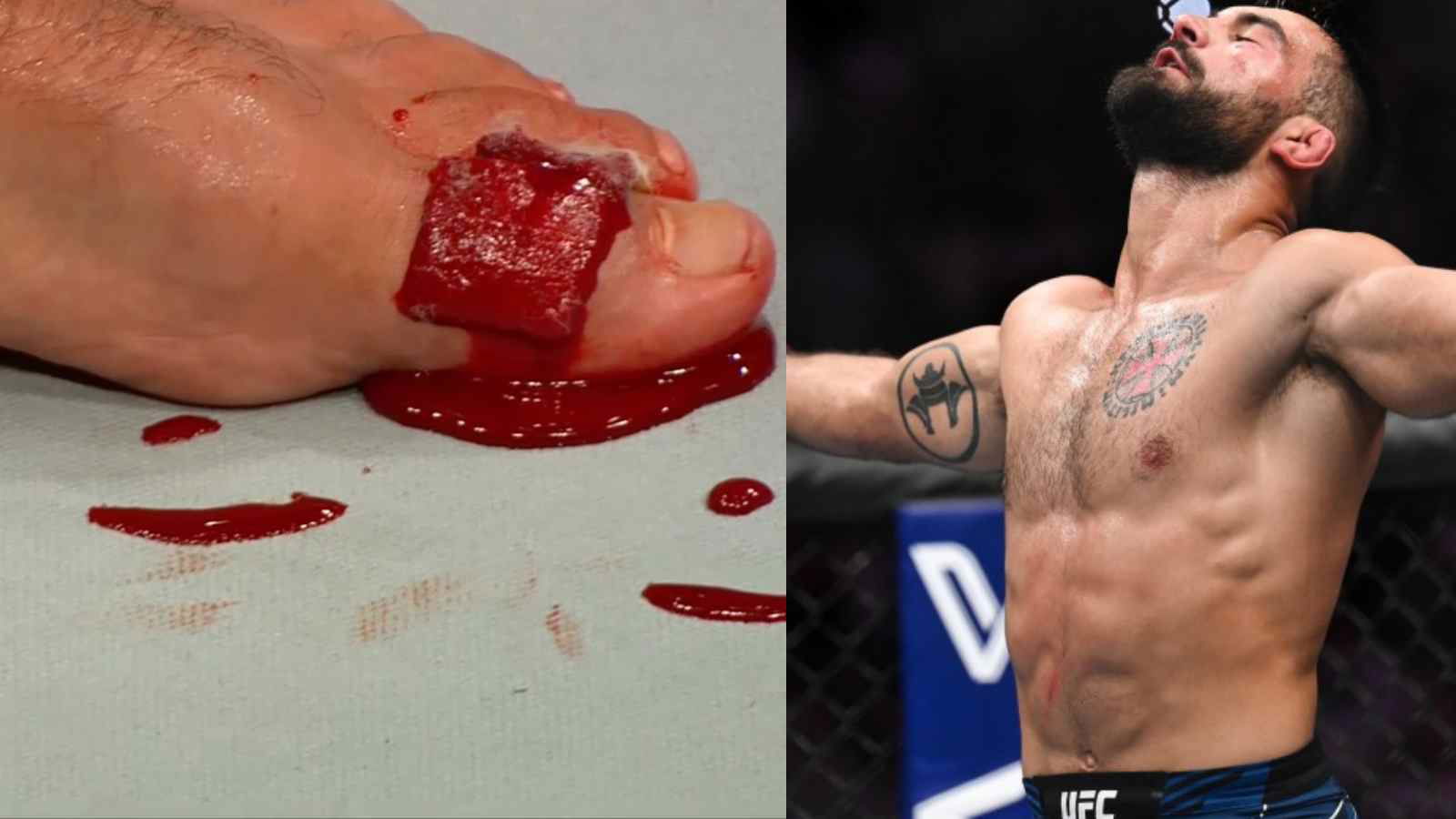 WATCH: Benoit Saint-Dennis suffers a brutal injury as his toes “Rip in 2” during UFC Paris second-round TKO win