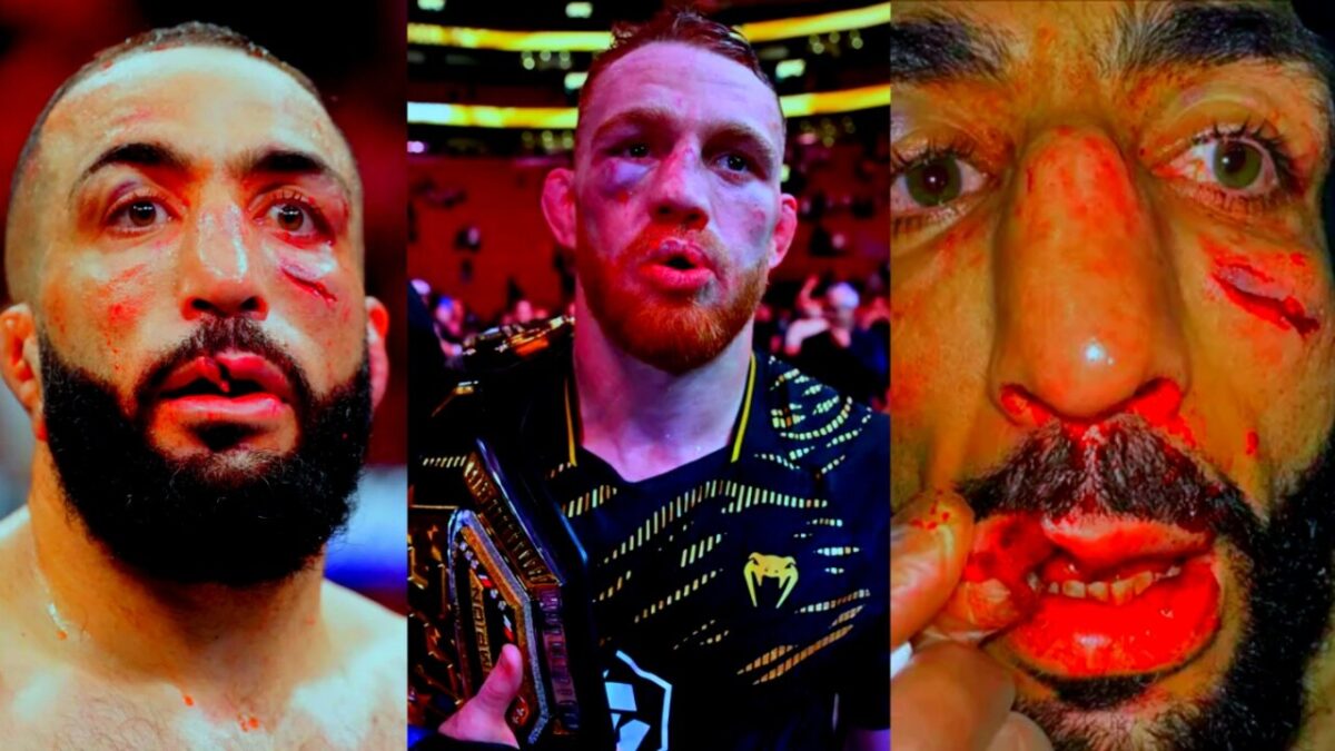 'Belal Muhammad Hater' Alexander Volkanovski's Reaction to Compatriot's Beating at UFC 315 Goes Viral 3 Belal Muhammad got gruesome cuts at UFC 315 against Jack Della Maddalena