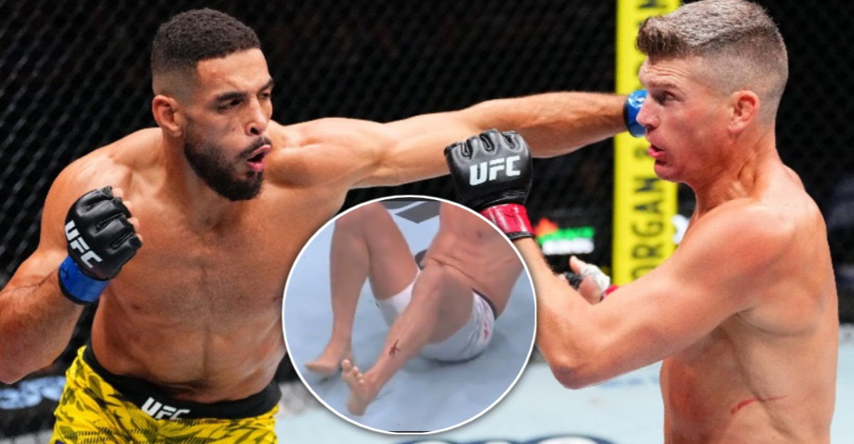 Fans Stunned as Stephen ‘Wonderboy’ Thompson Fights with ‘Gaping Hole’ in Shin at UFC Nashville