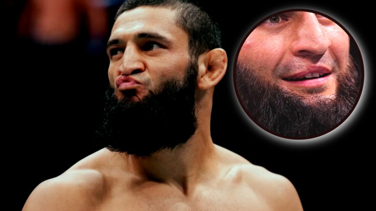 UFC 319's Khamzat Chimaev sports a dent on his lips