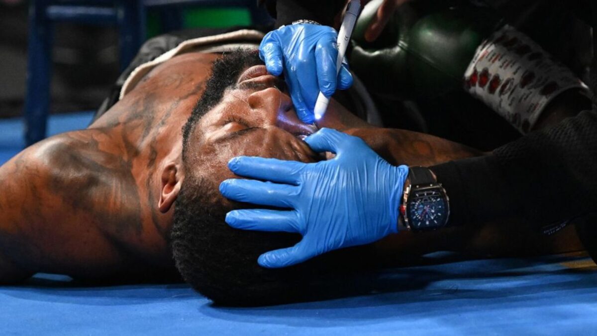 (Video) Boxer Joseph George's Terrifying Collapse in Corner During Fight Scares Fans 1 Joseph George getting checked by doctors