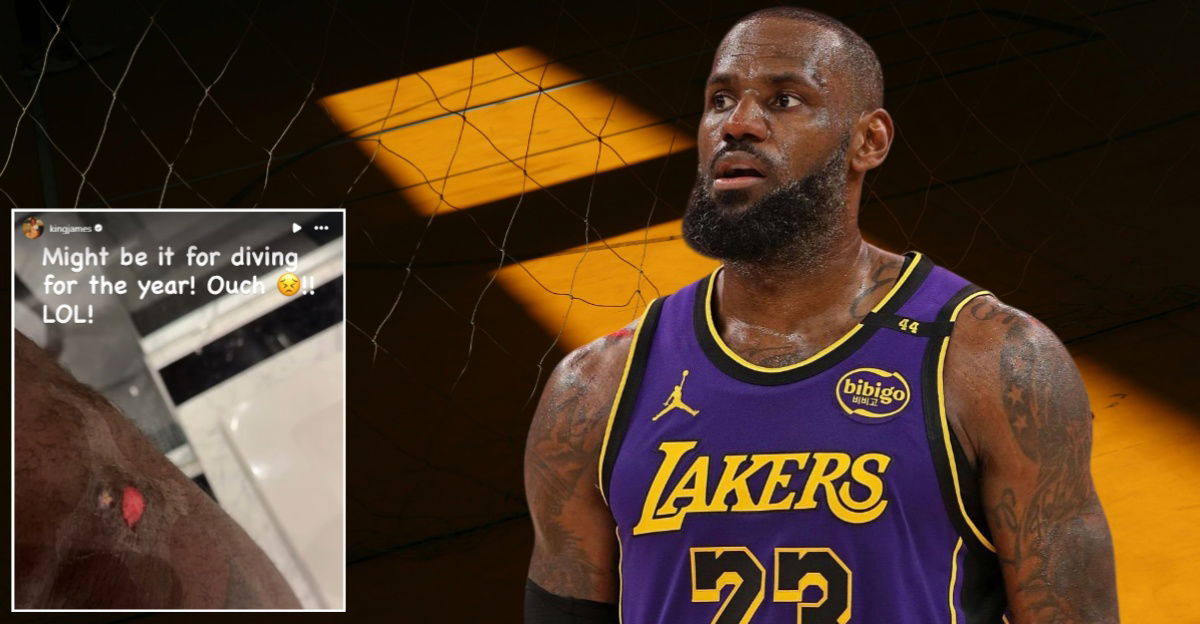 LeBron James Reveals Bloody Battle Scar from Head-First Dive in Nuggets Win