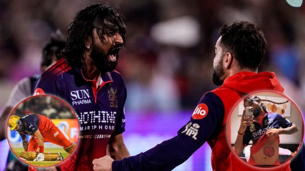 Krunal Pandya Believes Virat Kohli Would Be ‘GOAT’ in Any Generation 1 Krunal Pandya bruise