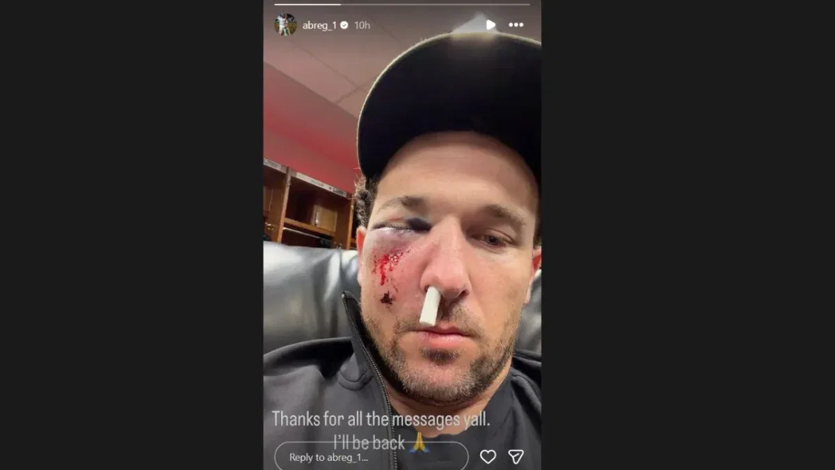Alex Bregman Shares Banged-Up Photo Following Nasty Hit to Face by Foul Ball 1 Alex Bregman's message